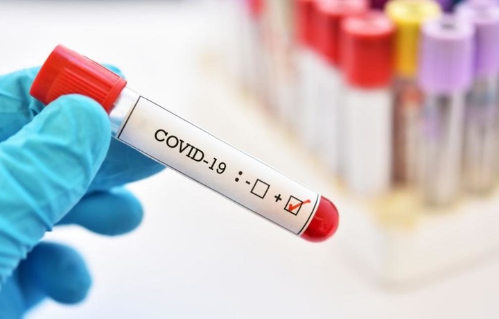 Koronavirus yuqtirganlar soni yana oshmoqda