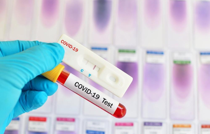 «Toshkent city», «Abu Saxiy» va «Megaplanet»da koronavirus aniqlandi