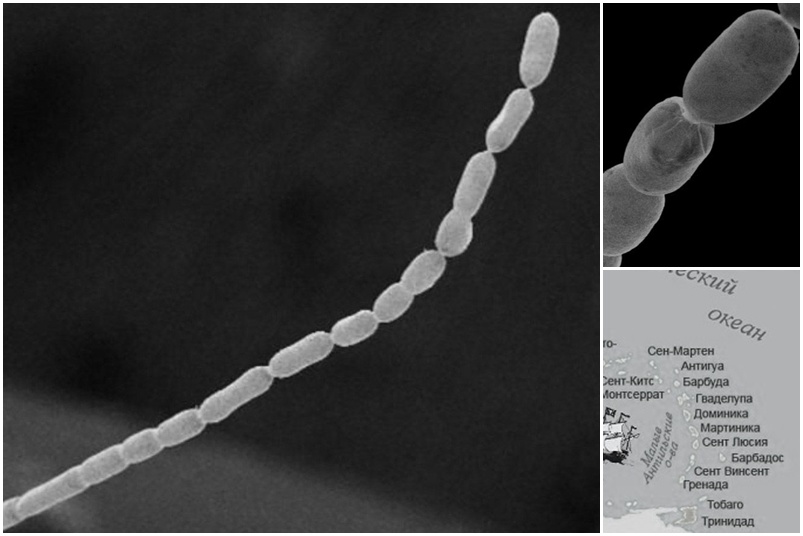 Eng ulkan bakteriya topildi — agar u odam bo‘lganida Everest bilan bo‘ylashardi