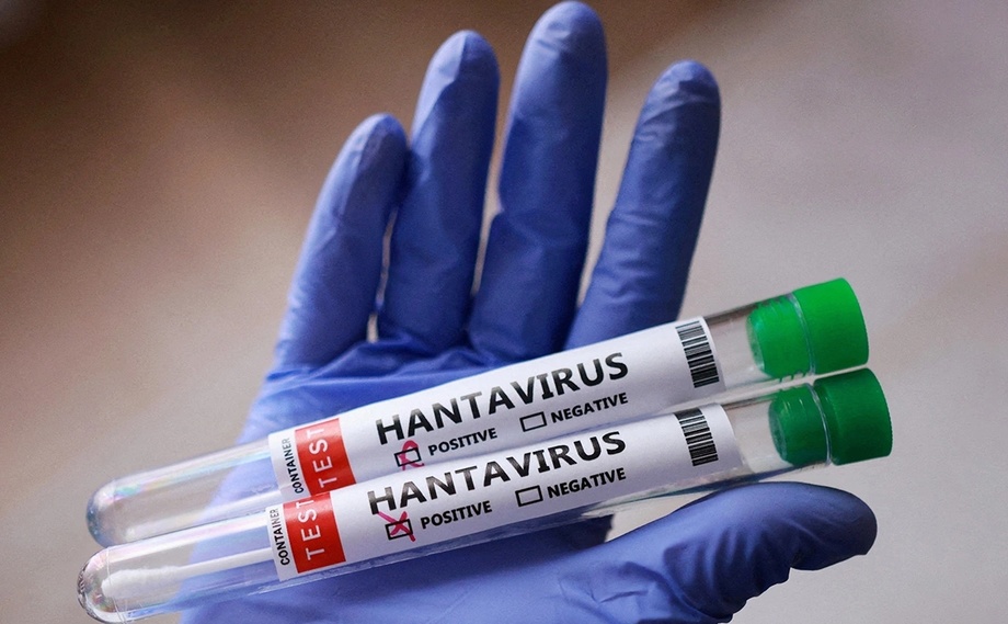 «Keng ko‘lamli epidemiya belgilari yo‘q, ammo vaziyat o‘zgarishi mumkin» — JSST xantavirus haqida