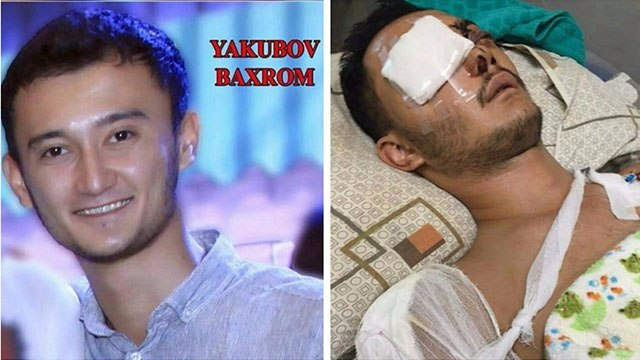 Aktyor Bahrom Yaqubovga salkam 100 mln. so‘m moddiy zarar undirib berildi