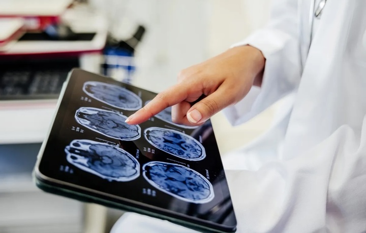 Хитойда Neuralink чипларидан устун бўлган мия имплантини қўллаш бошланди