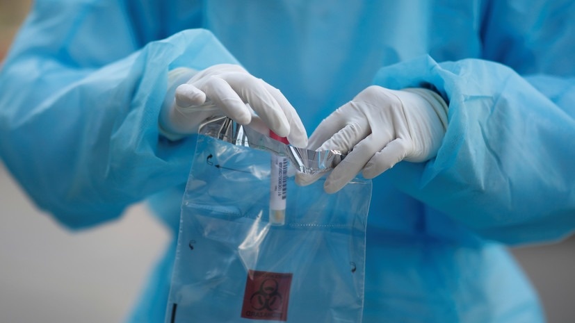 Yana 5 kishida koronavirus aniqlandi. Ular soni 172 nafarga yetdi
