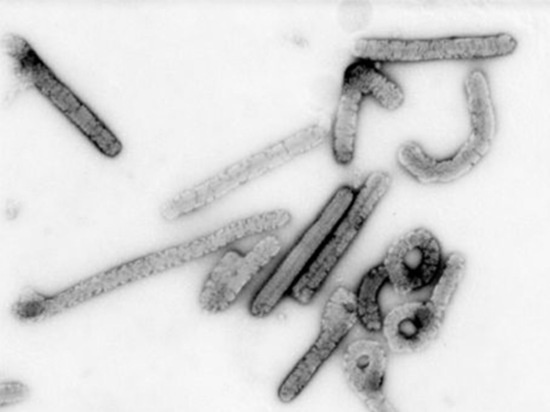 G‘arbiy Afrikada xavfli virus yuqtirgan ilk bemor vafot etdi