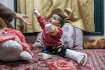 BMTga ko‘ra, G‘azoda har kuni 10 nafar bola bir yoki ikki oyog‘idan ayrilmoqda. Foto: Al Jazeera. 