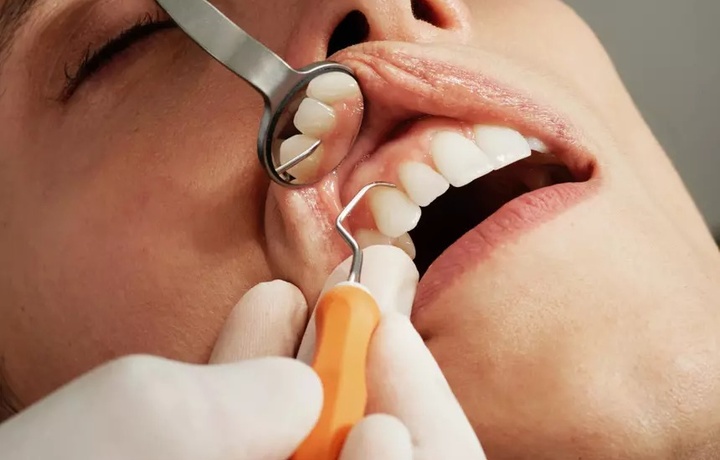 Как COVID влияет на здоровье зубов и дёсен
