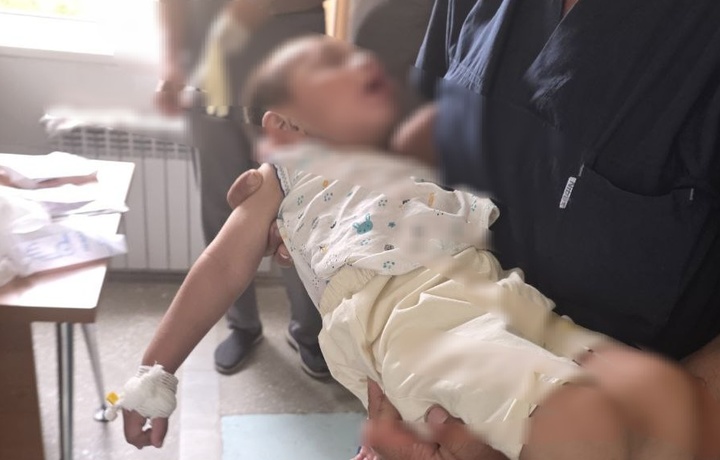 Бухорода танга ютиб юборган бола ҳаёти сақлаб қолинди