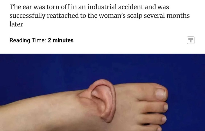 Хитойда жарроҳлар ноодатий амалиётга қўл уришди