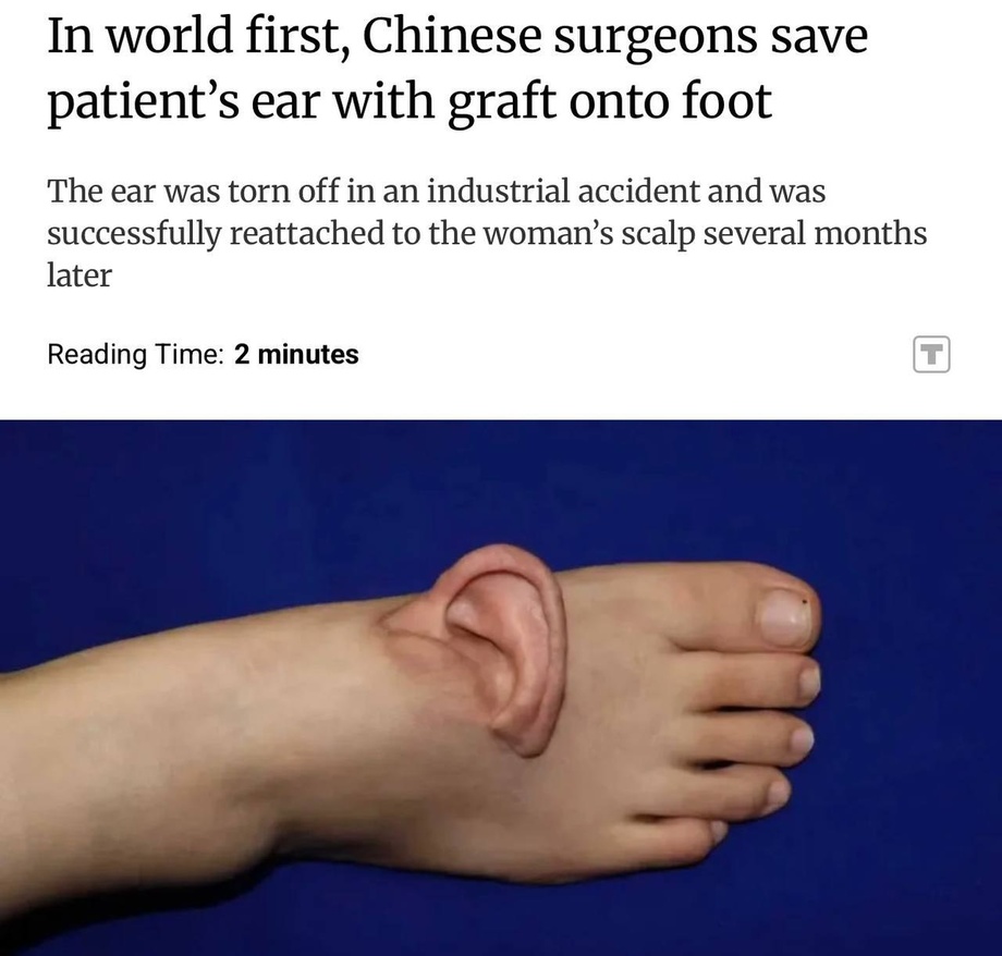 Xitoyda jarrohlar noodatiy amaliyotga qo‘l urishdi