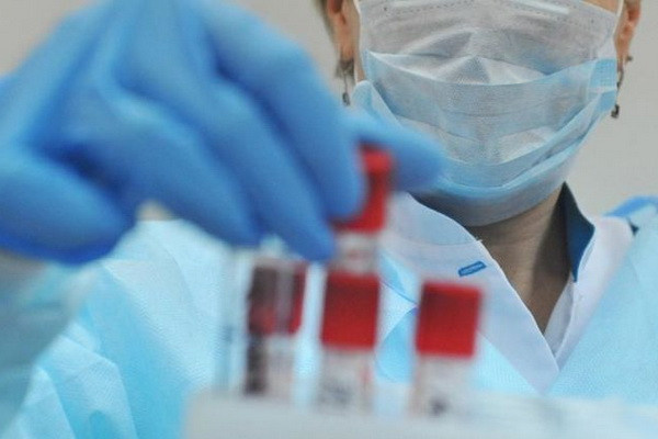 Koronavirus: O‘zbekistonda aprel oyidagi eng past ko‘rsatkich qayd etildi