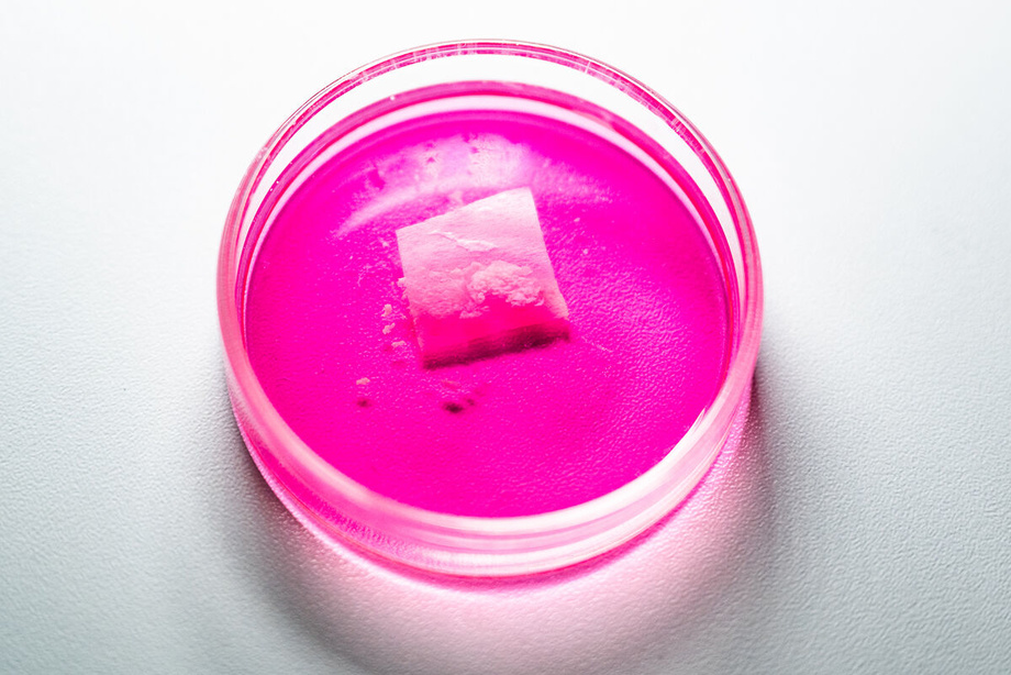 Rossiya transplantatsiya uchun sun’iy mushaklarni ishlab chiqdi