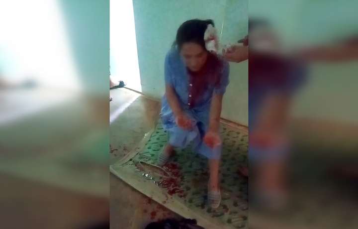 В Самарканде заведующая детским садом разбила бокалом голову методиста