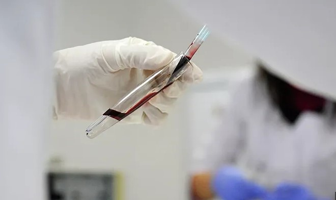 Петербургда маймун чечаги билан боғлиқ иккита ҳолат қайд этилди