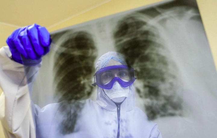 Olimlar koronavirus yuqish xavfini uch baravar kamaytiradigan kasallikni aniqlashdi