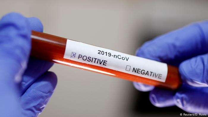 У Палестины заканчиваются материалы для тестов на коронавирус