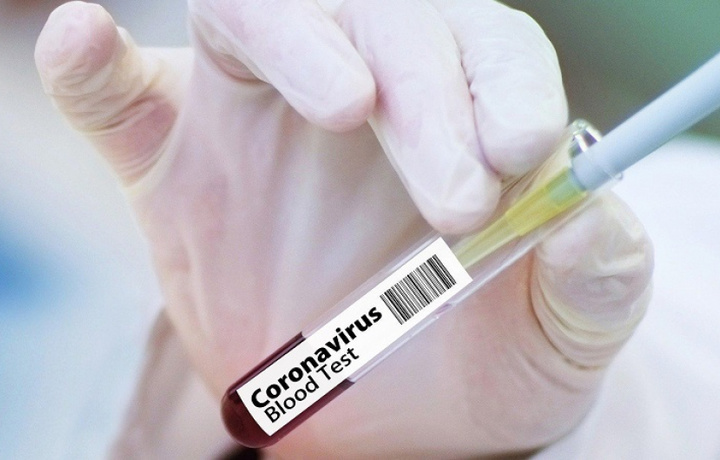 Bir necha soat ichida yana 90 kishida koronavirus aniqlandi