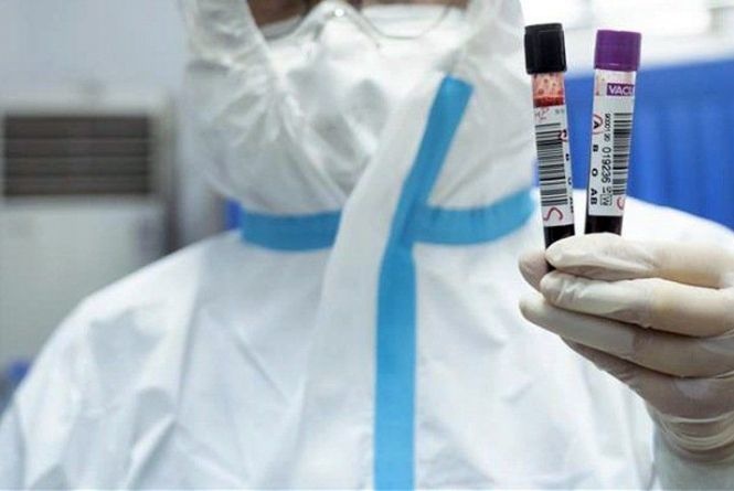 В Узбекистане зафиксированы новые случаи заражения коронавирусом