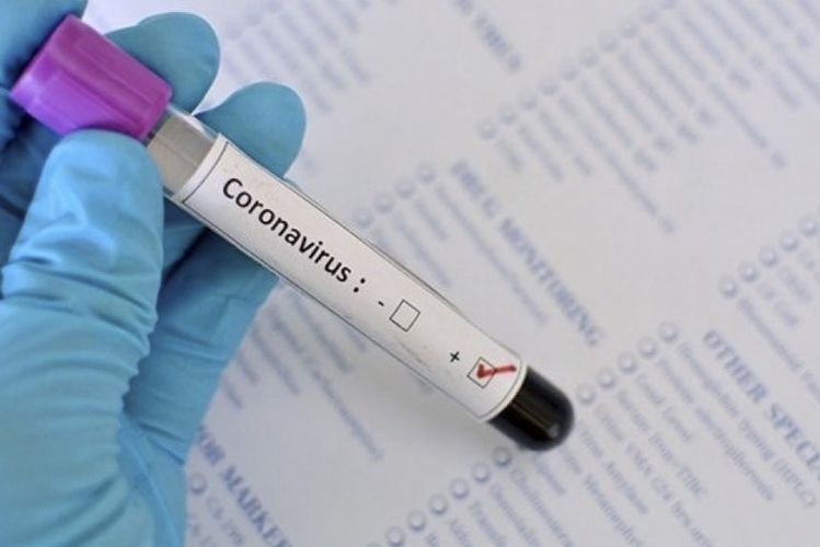 Koronavirusga chalinganlar soni 13 000dan oshdi (+196)