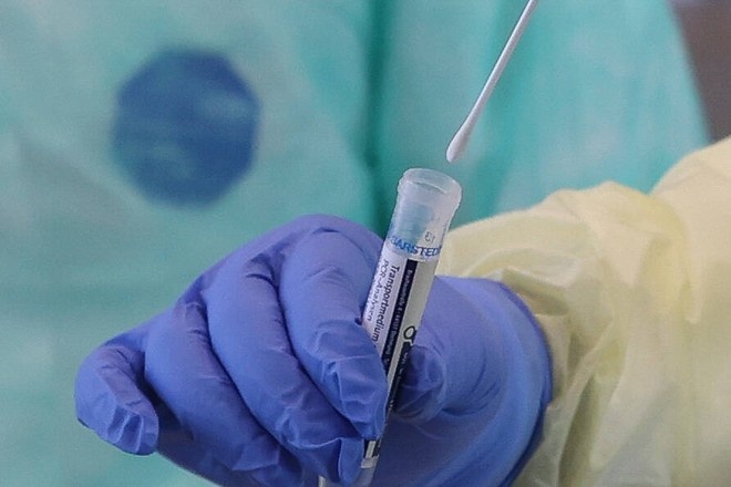 В Узбекистане увеличилось число заболевших коронавирусом