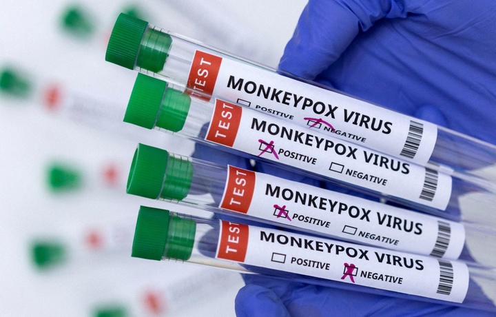 Во Вьетнаме выявили первый случай заражения человека вирусом оспы обезьян