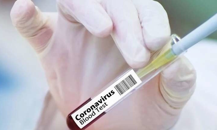 Коронавирус инфекцияси аниқланганлар сони ошди